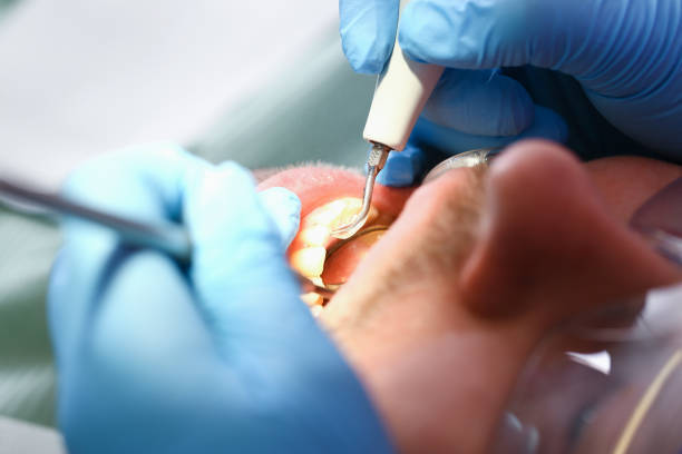 Best Weekend Emergency Dentist in Canadian, TX