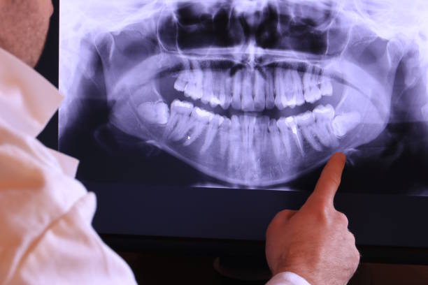 Best Urgent Dental Care for Toothache in Canadian, TX