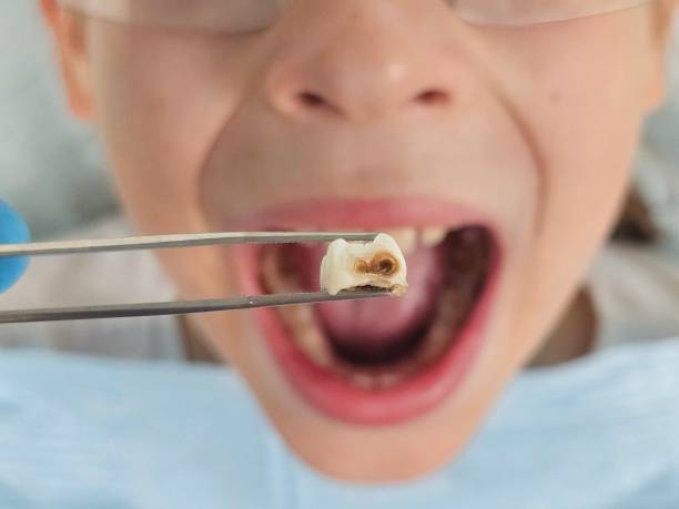 Best Emergency Cosmetic Dentistry in Canadian, TX